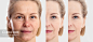 皱纹-standard-scale-2_00x-gigapixel