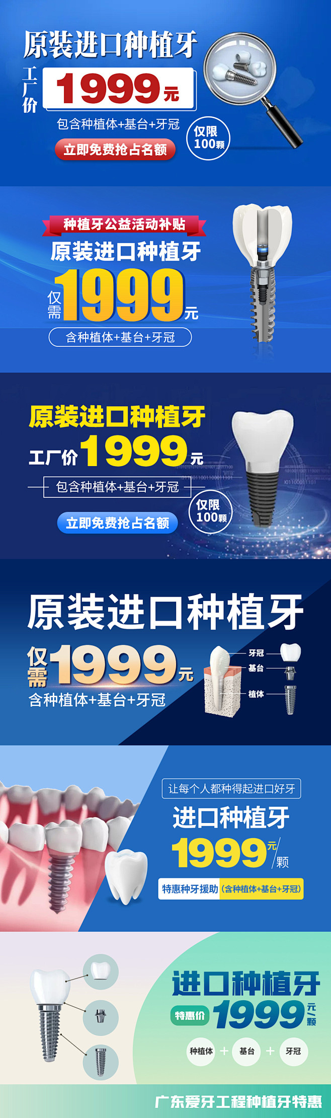种植牙头图合集
