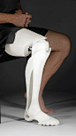 3D Printed Prosthetic Leg. Awesome!!!: 