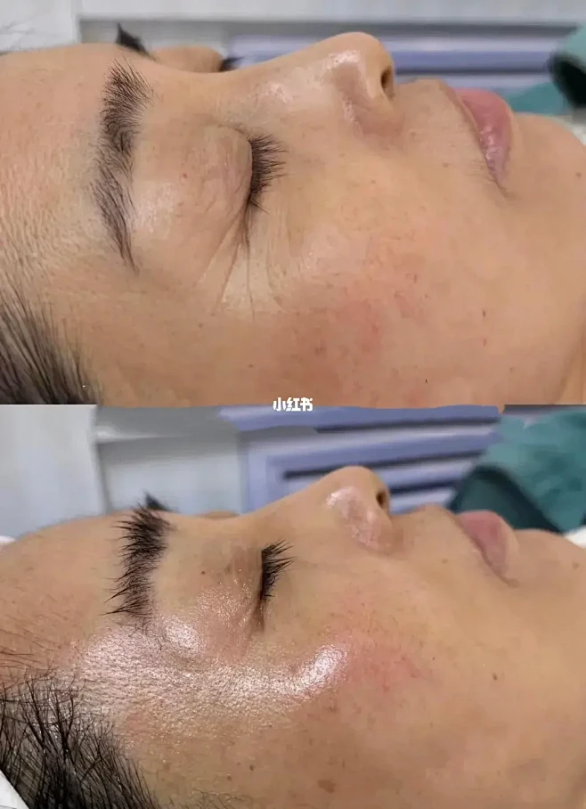 只要皱纹不长进心里