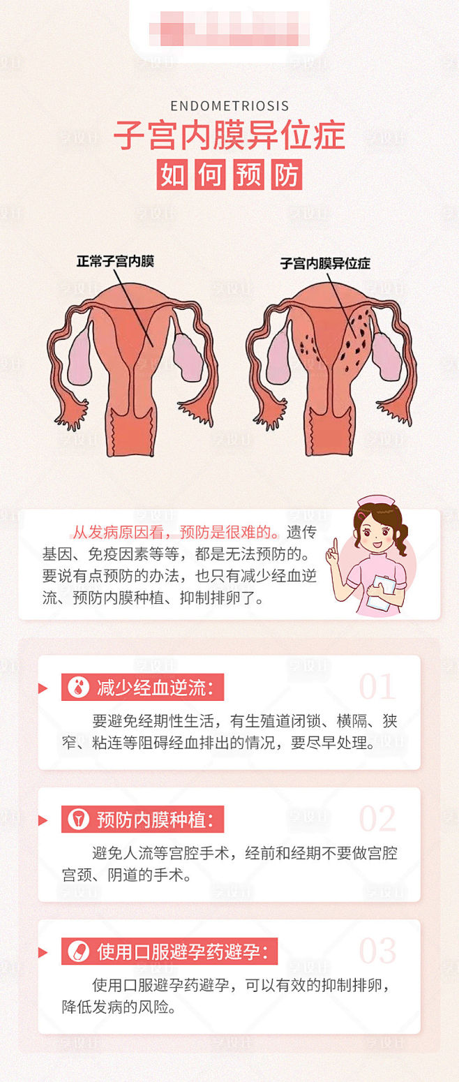 子宫内膜异位症不孕科普长图海报-源文件