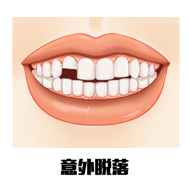 多颗牙缺失  个别牙缺失  门牙缺失  ...