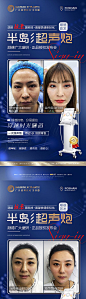 医美超声炮全面部抗衰-源文件