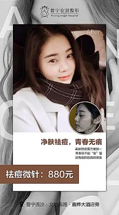 祛痘微针整形海报-享设计