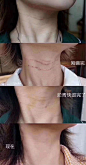 泉州美莱华美医疗美容的微博_微博