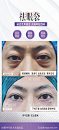 祛眼袋案例海报-源文件-志设网-zs9.com
