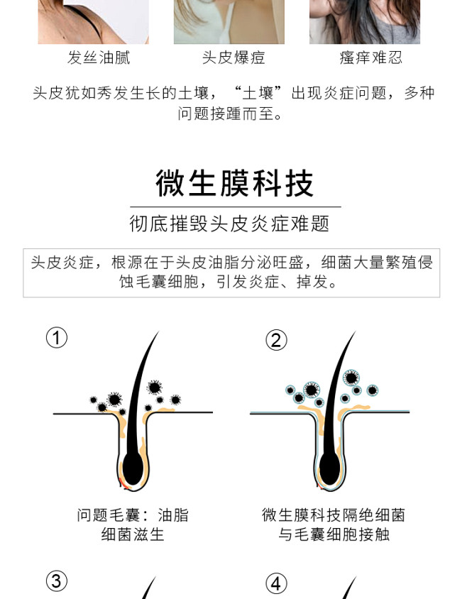 ALRA温和止痒洗发水控油清洁脂溢性防脱...