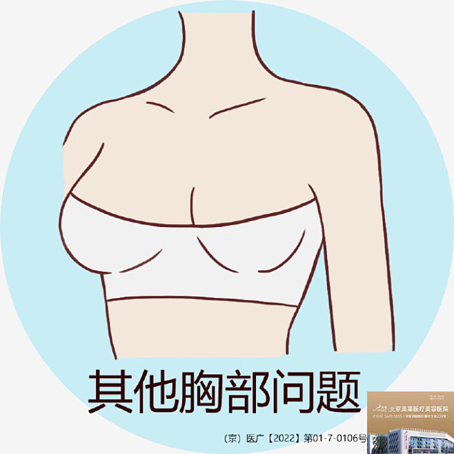 #北京美胸计划0元招募#开始啦！
九大胸...