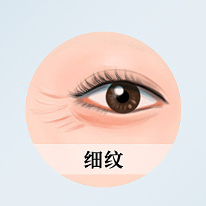 细纹