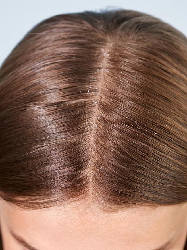 Look of hair before ...