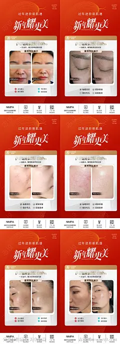 伊诺锶黄金微针医美创意海报-源文件-志设网-zs9.com