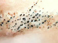 点击查看源网页