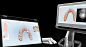 iTero Intraoral Scanner | iTero Intraoral Scanner