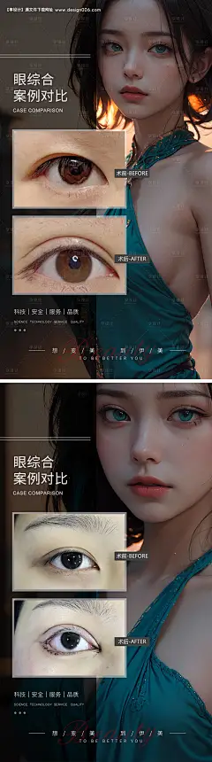 源文件下载【眼综合案例对比系列海报】编号：20230913090805591