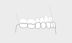 hnsylei采集到Tooth