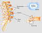 
请勿擅自用于商业用途 
http://www.fpnotebook.com/_media/LumbarSpineAnatomyDisc.gif