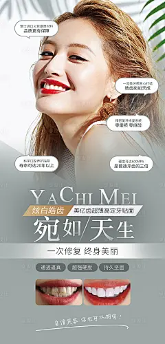 瓷贴面牙齿美容海报-源文件
