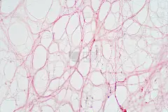 镜下为网状结缔组织。人类生理学的组织学。
