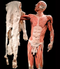 Gunther von Hagens和他创作的尸体标本。
于2011年患帕金森，声明死后愿将自己的尸体捐赠、用于展出 ​​​​