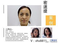 设计师张图图采集到案例