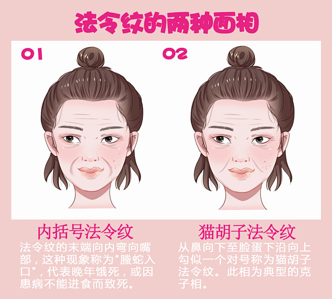 法令纹 脸部 面部 去法令纹 法令纹类型 法令纹种类 法令纹对比 法令纹图片 面部填充法令纹 玻尿酸填充法令纹 去皱 去除法令纹 除皱 脸部 ...