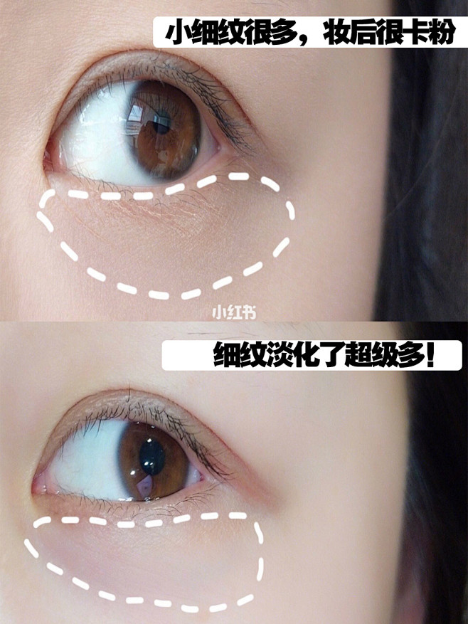 3个最去细纹办法❗️谁才是去干纹收割机！...