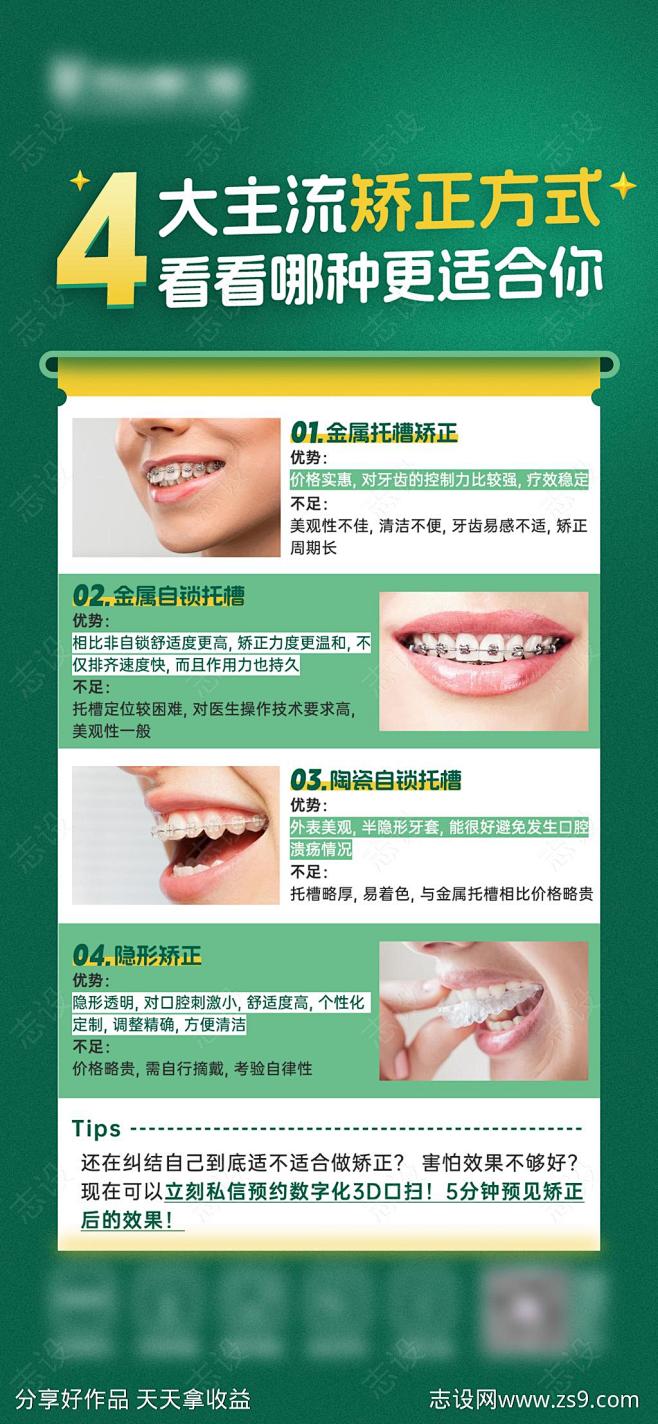 4大主流矫正方式-源文件-志设网-zs9...