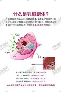 乳腺增生 【酷图网】腺增生,癌前病变,粉色,乳腺疾病,乳腺癌,发展过程