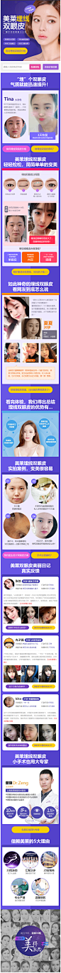上海美莱埋线双眼皮——属于你的美眼小心机_上海美莱医疗美容门诊部