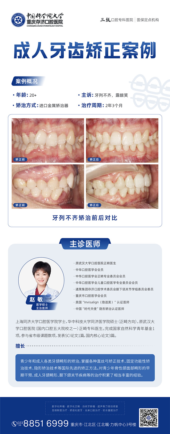 成人牙齿矫正案例_成人牙齿矫正