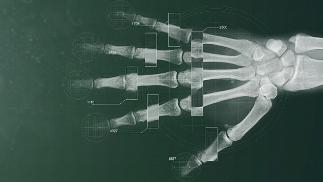 未来手持X射线扫描与分析