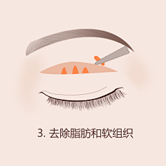 🐣Sunshinee°采集到医美插画