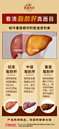 脂肪肝
