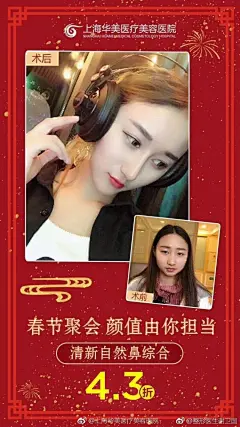 【春节聚会，颜值由你担当】
工作忙？   没时间整形？想做鼻子的你还在等什么，清新自然鼻综合低至4.3折  ， 天拥有挺翘美鼻，春节聚会，秒变女神。#上海身边事##隆鼻##鼻面综合整形##医美科普##今日立春# ​​​ ​​​​