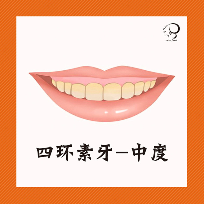 牙齿美白海报