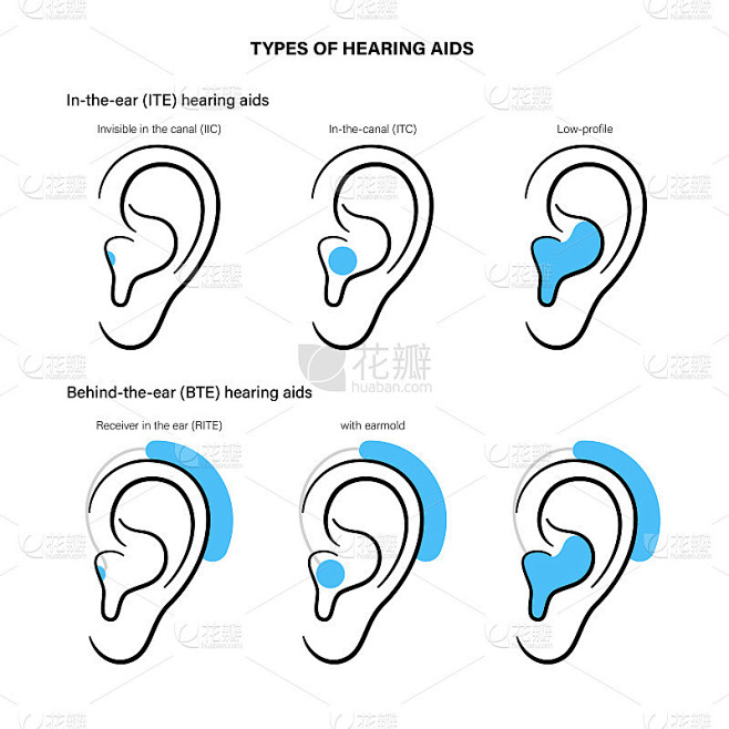 助听器类型