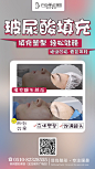 玻尿酸填额头