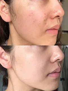 -1616-的笔记_HABA清洁效果怎么样_HABA面膜怎么样_小红书