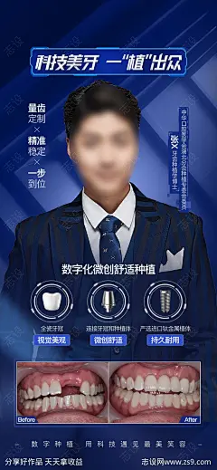 口腔专家种植牙案例宣传海报-源文件-志设网-zs9.com