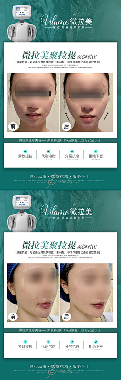 胡小小星采集到普拉提