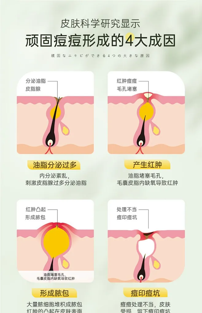 祛痘痘印痘坑非修复膏淡化去痘印非痘疤凹洞男女正品-tmall.com天猫-花瓣网