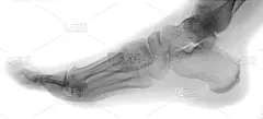 足,踝,人类脚趾,人类骨架,水平画幅,部分,白色,脊柱,x光