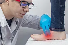 一位整形外科医生正在检查一位女士的腿。足部疼痛，肌腱扭伤，炎症，扁平足，滑囊炎，筋膜炎。足部疾病的治