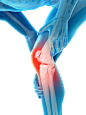 人体三维 3D 各种痛 透视骨骼  膝盖痛腿痛