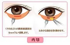 整容液| 眼袋对人影响有多大？能让苏大强撞脸吴彦祖的那种大 : 最近全国人民都在追的电视剧《都挺好》中承包了海豹君三分之二笑点的苏大强继各种表情包后再携“论眼袋对一