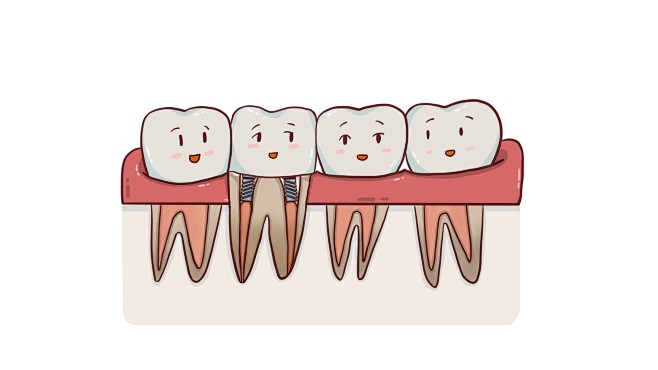 美容牙齿  美白牙齿  拯救龋齿  牙髓...