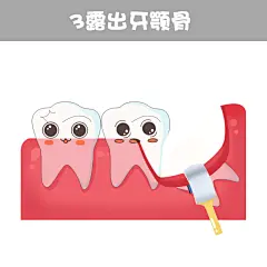 拔智齿 ​​​ - @整形医生薛磊的微博 - 微博