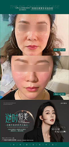 阿球不是球采集到医美案例
