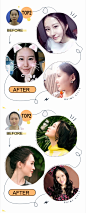 【鼻综合】打造360度上镜小翘鼻(假体隆鼻+耳软骨垫鼻尖+鼻头缩小)_整形优惠预约-新氧美容整形