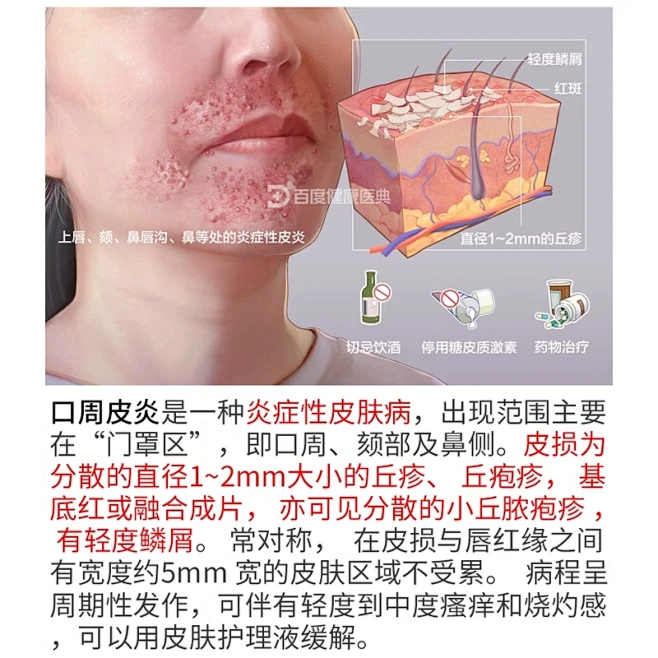 口周皮炎嘴唇嘴巴周围红斑丘疹瘙痒过敏起皮专用唇周炎可搭药膏WQ-tmall.com天猫-花瓣网